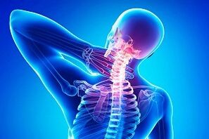 muguras sāpes kā osteohondrozes simptoms