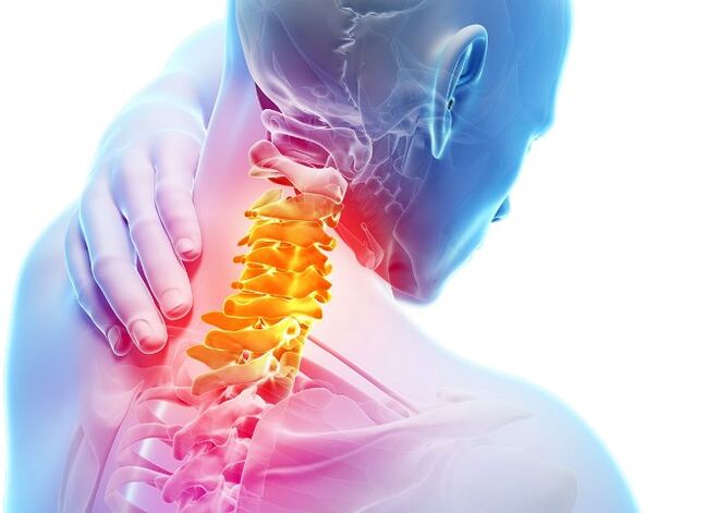 Dzemdes kakla osteohondrozes attīstības simptomi un posmi