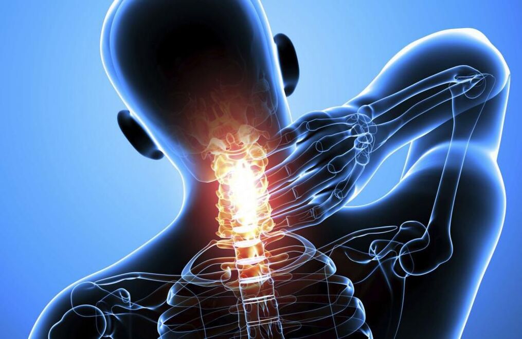 Mugurkaula kakla mugurkaula osteohondroze